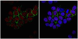 RNF168 Rabbit anti-Human, Mouse, Polyclonal, MilliporeSigma 100&mu;g; Unlabeled:Antibodies,
